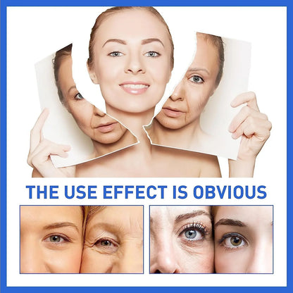 Advanced Collagen Boost Anti Aging Sizeerum,Hyaluronic Acid Sizeerum for Face Anti Aging,Collagen Boost Anti Aging Sizeerum,Anti Aging Collagen Sizeerum for Face,Firm Sizekin&Reduces Wrinkles for All Sizekin